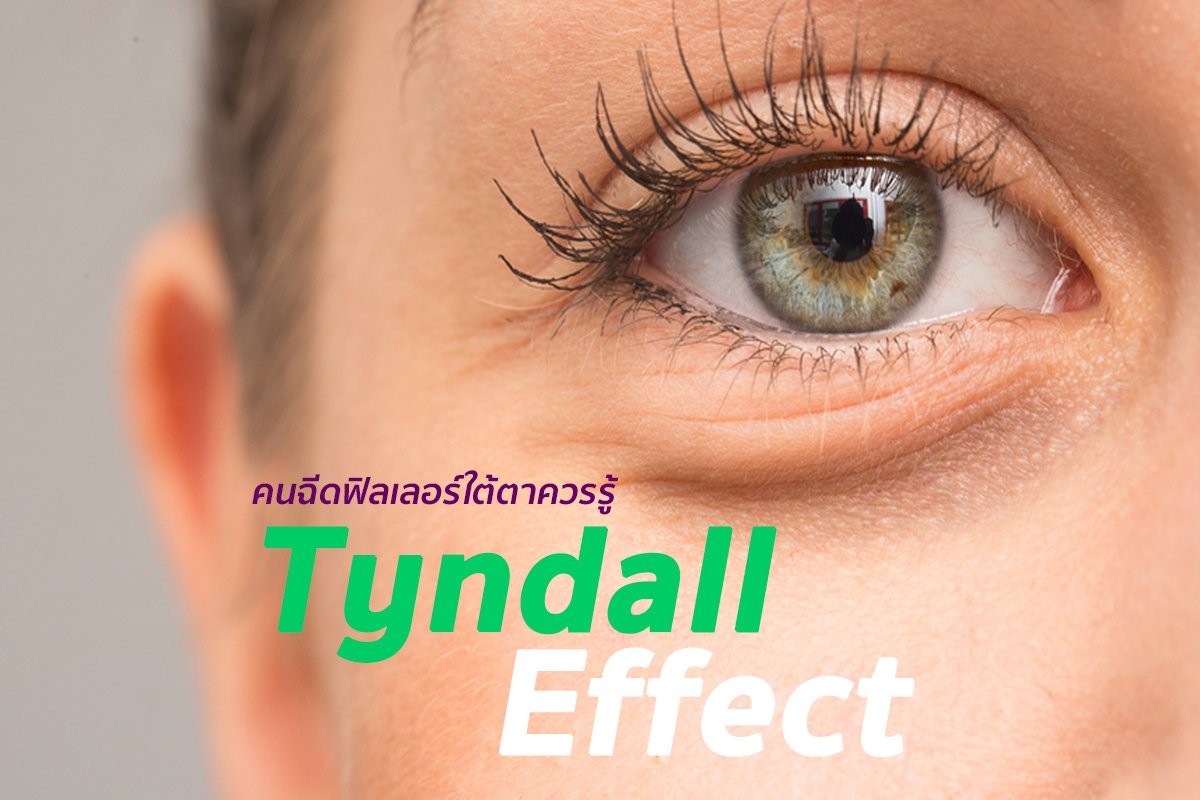 Tyndall Effect Goodwill Clinic