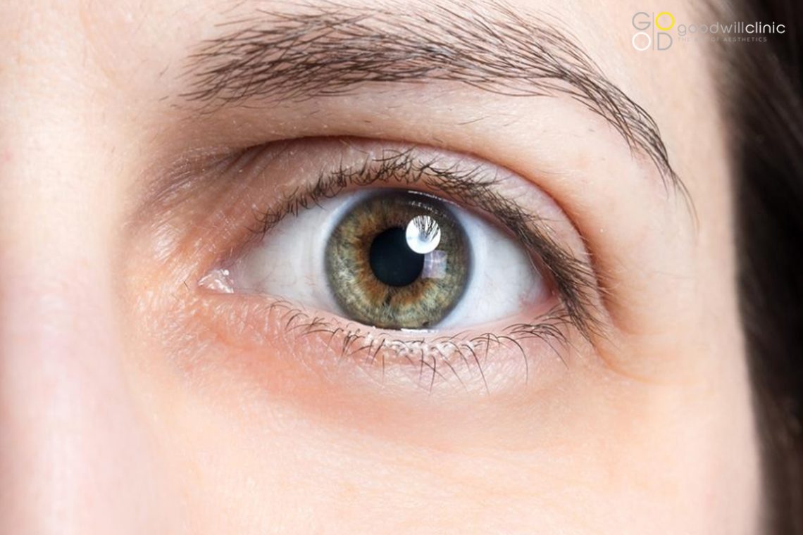 Tyndall Effect Goodwill Clinic