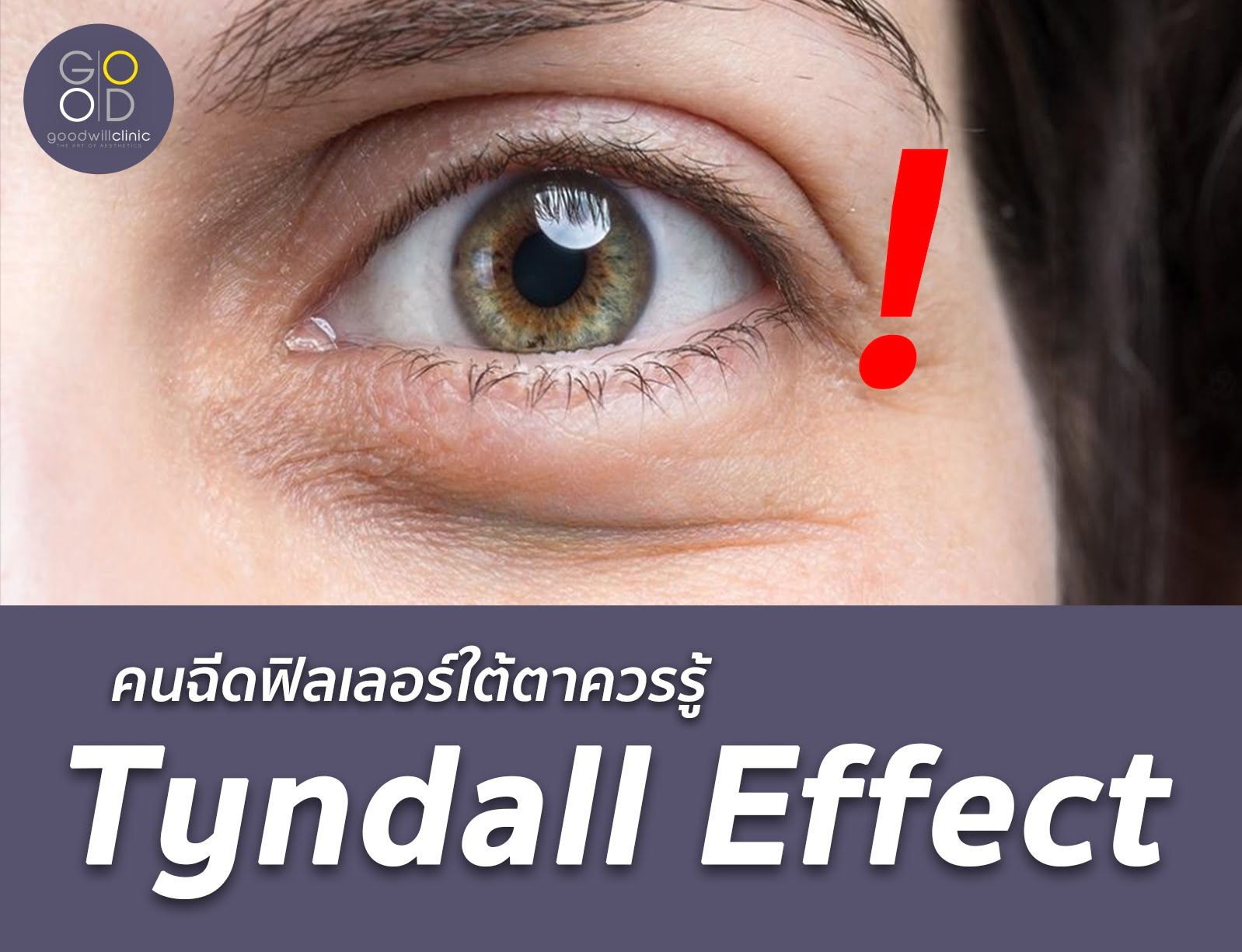 Tyndall Effect Goodwill Clinic